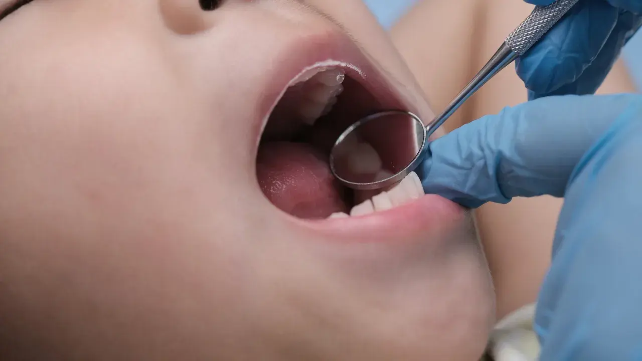 Esame dentistico: un piccolo specchietto riflette la bocca aperta di un bambino, mostrando la lingua e alcuni puntini sul palato.