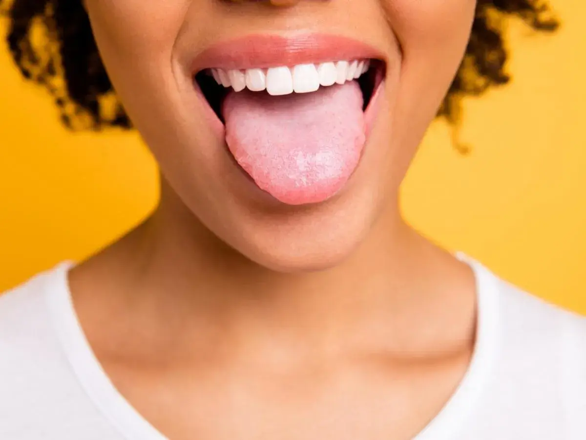 Bocca aperta con lingua rosa che sporge, un po' di bianco si nota, forse perchè ho la lingua bianca. Sorriso smagliante su sfondo giallo.