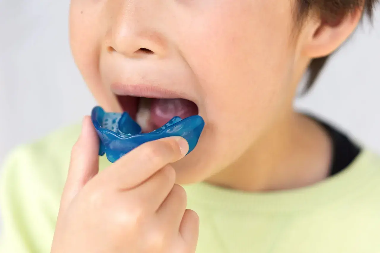 Bambino con apparecchio blu in bocca, parte di un percorso di terapia miofunzionale per migliorare la funzione orale.