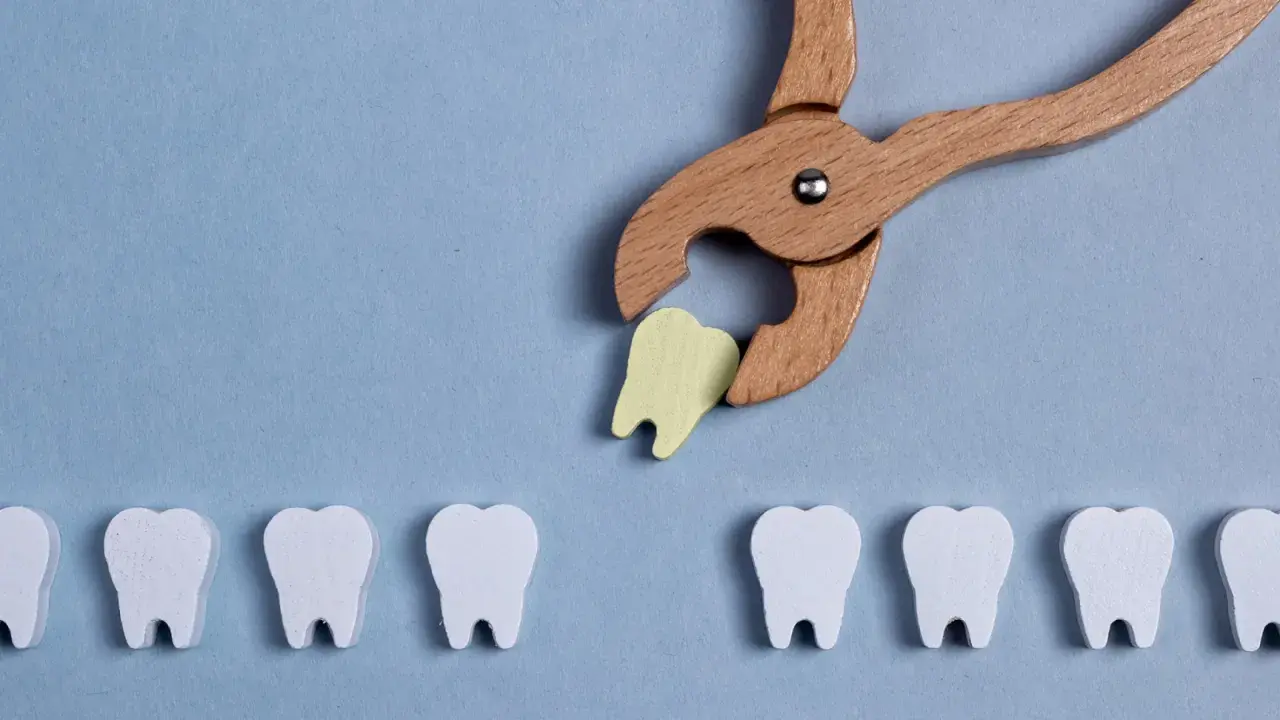 Pinze in legno estraggono un dente giallo da una fila di denti bianchi. Simboleggia la guarigione dopo l'estrazione del dente.