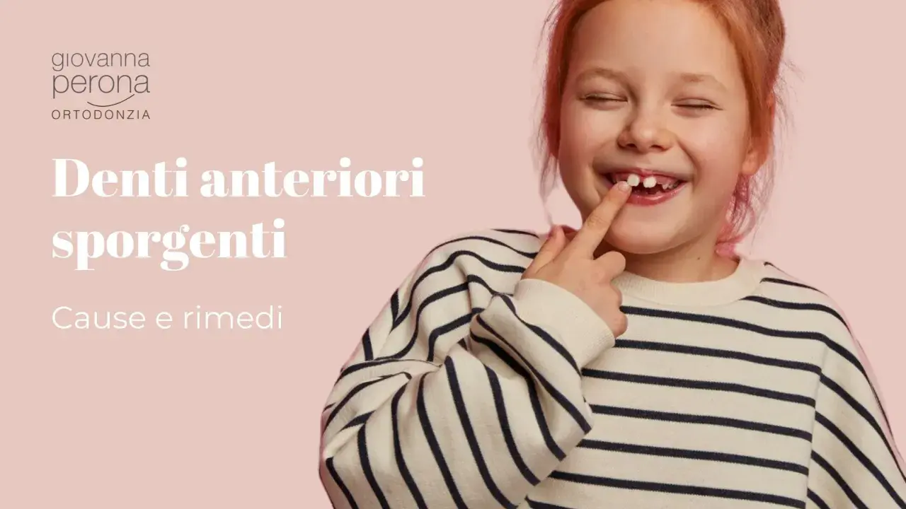 Bambina con denti anteriori sporgenti, che indica il problema. Scopri cause e rimedi fai da te per i denti sporgenti.