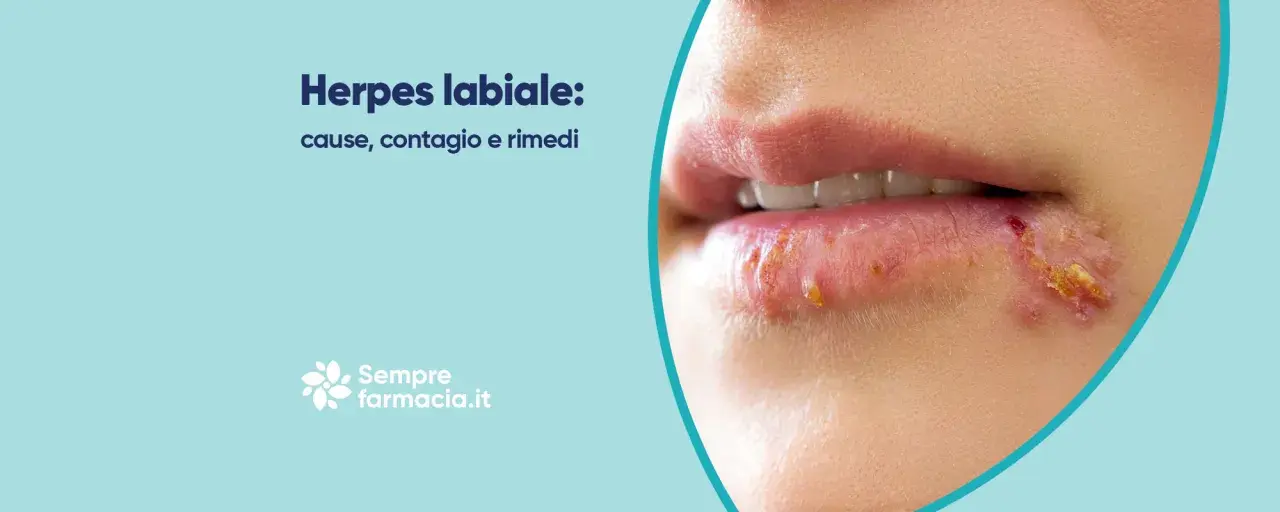 Labbra con herpes, un disturbo comune. Scopri cause, contagio e rimedi per il herpes lingua.