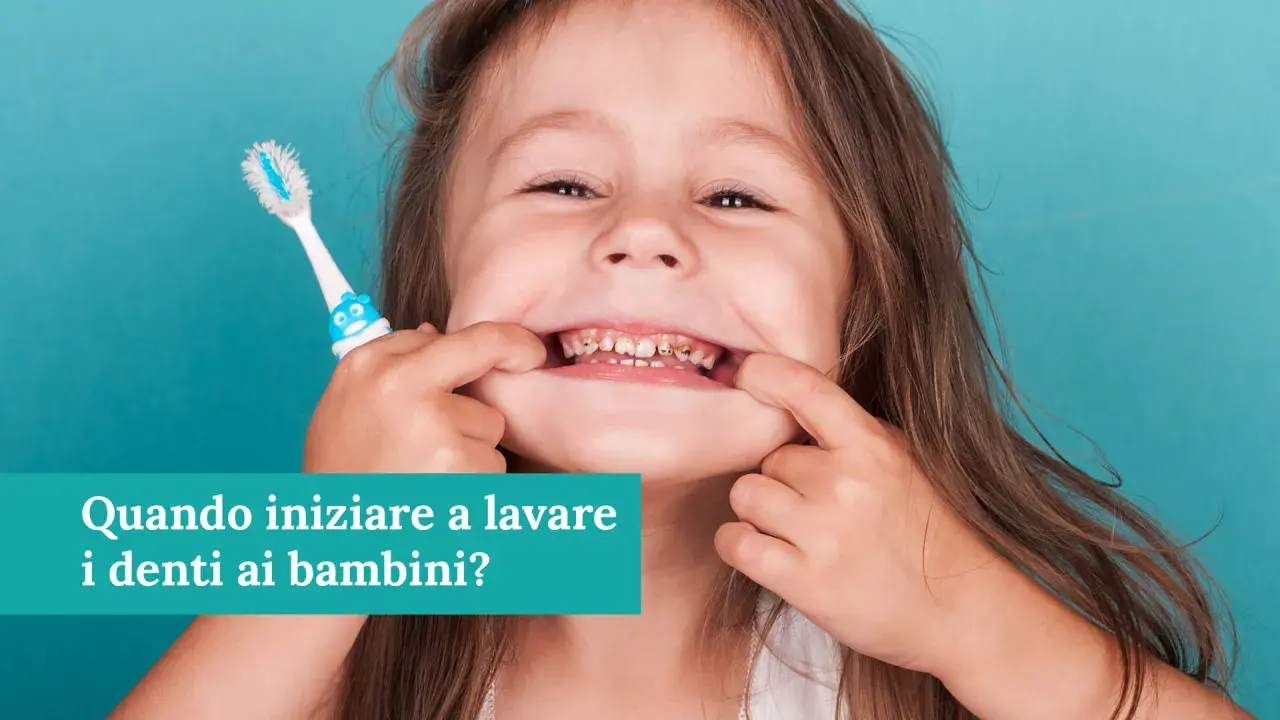 Bambina mostra denti cariati, con spazzolino. La psicologia del non lavarsi i denti può portare a problemi di salute orale fin da piccoli.