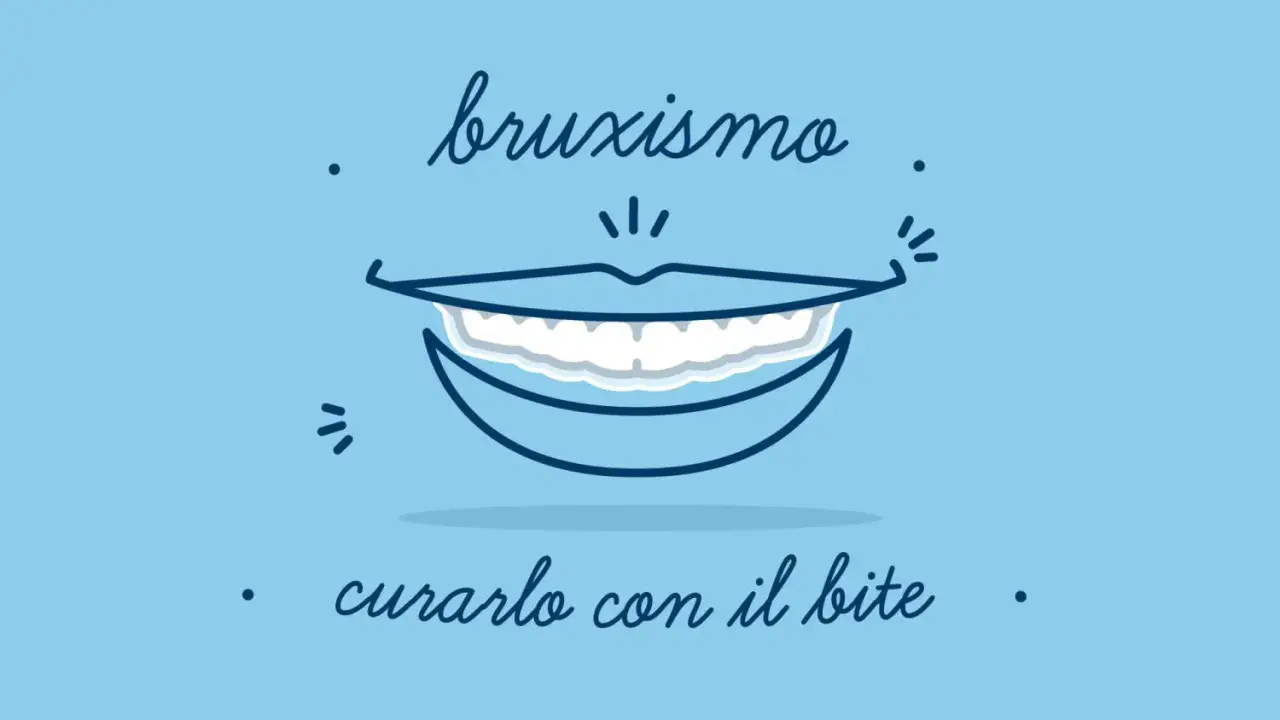 Bruxismo: un sorriso che stringe i denti. Scopri i rimedi, come il bite, per alleviare il serramento notturno.