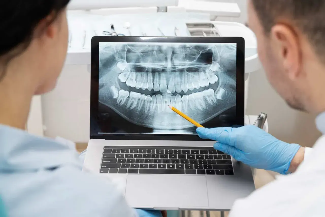 Dentisti analizzano un'ortopanoramica dentale su un laptop, seguendo il principio Alara per minimizzare l'esposizione.