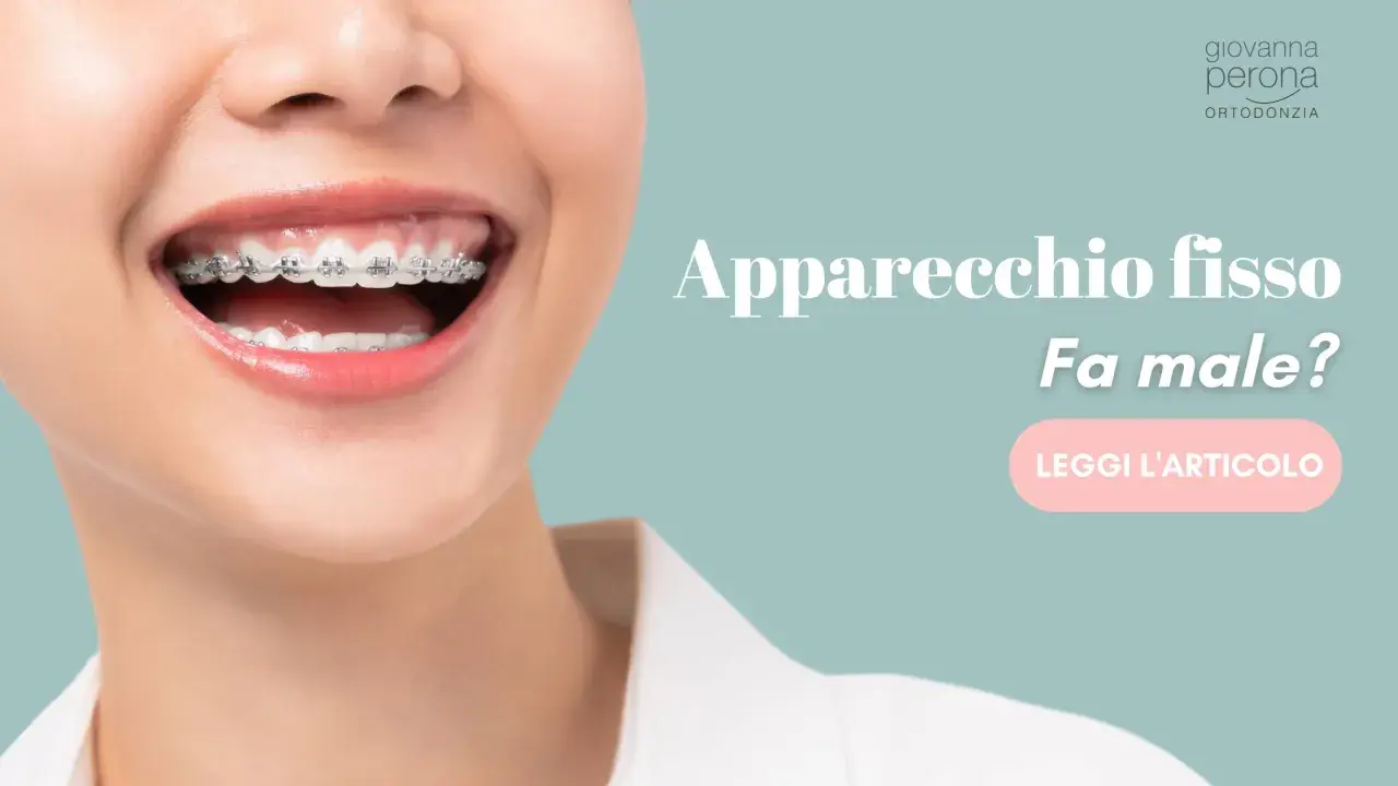 Sorriso con apparecchio fisso. Fa male togliere l'apparecchio fisso? Scopri di più leggendo l'articolo.