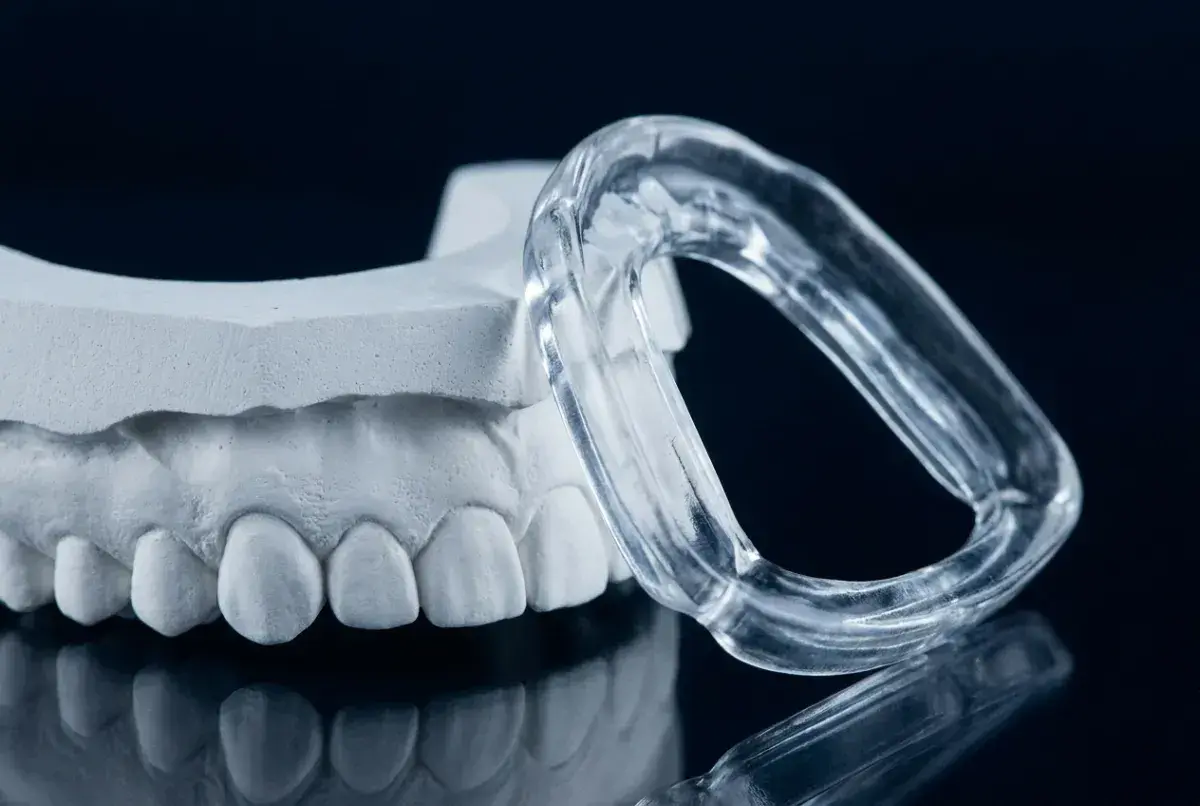 Modello dentale e bite trasparente, soluzione per il bruxismo consigliata dal dentista.