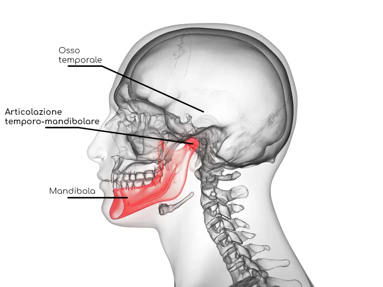 Illustrazione anatomica del cranio che evidenzia l'articolazione temporo-mandibolare, la mandibola (in rosso) e l'osso temporale. Utile per comprendere la disfunzione temporo mandibolare.