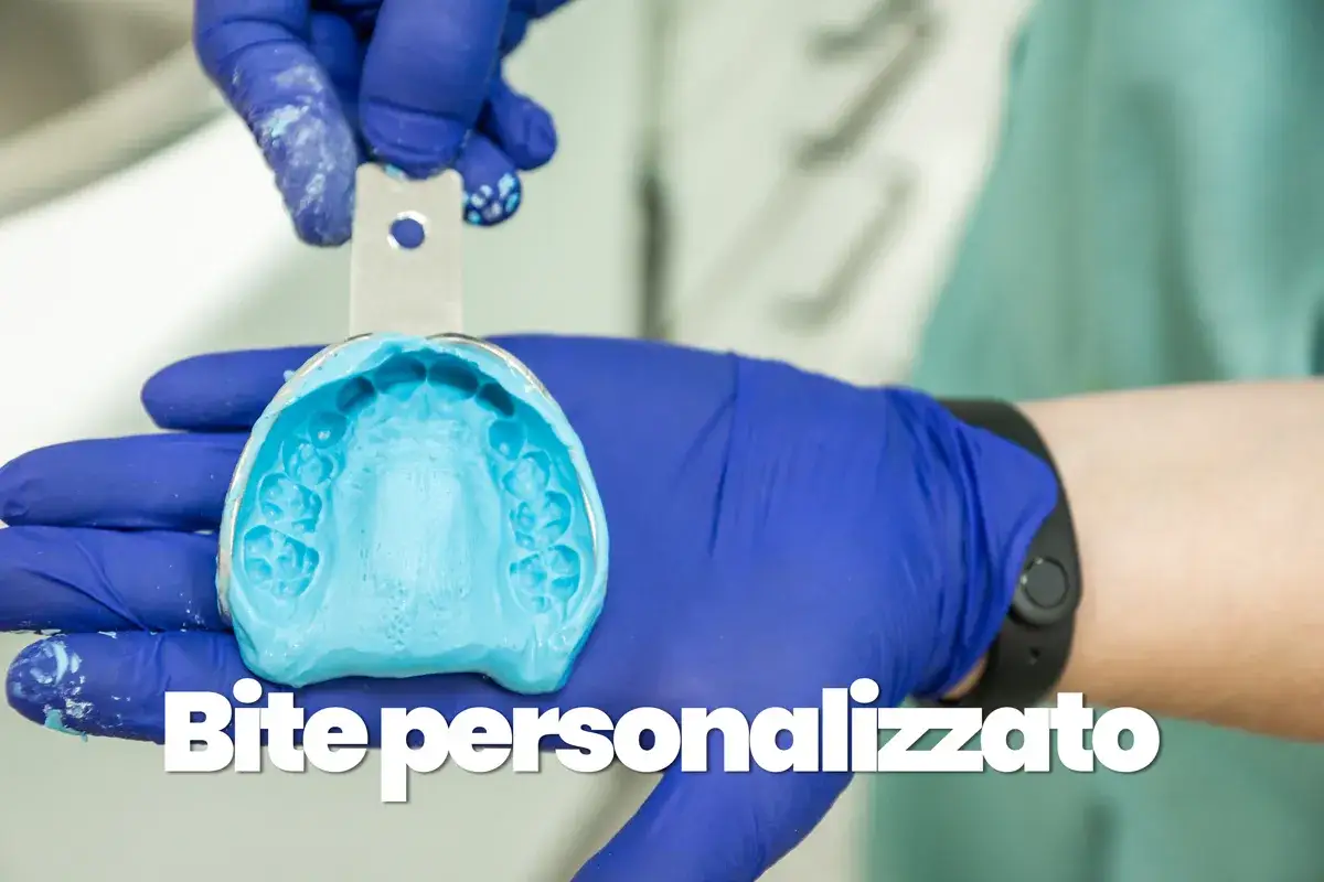 Un tecnico con guanti blu tiene un'impronta dentale azzurra. Questo è il primo passo per creare un bite personalizzato, perfetto per ogni sorriso.