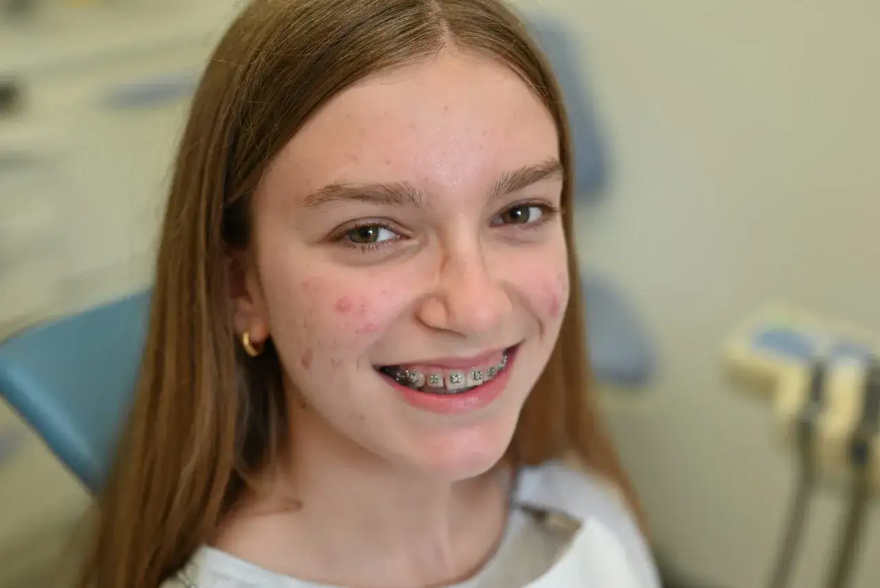 Ragazza sorridente con apparecchio fisso trasparente, che mostra i denti allineati.