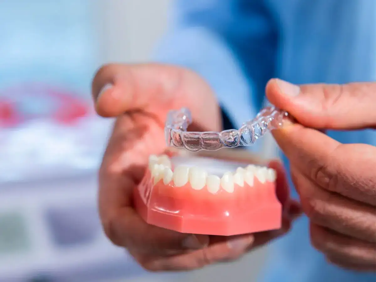 Un dentista mostra un modello di denti e una mascherina trasparente, spiegando ogni quanto si cambiano le mascherine Invisalign per un sorriso perfetto.