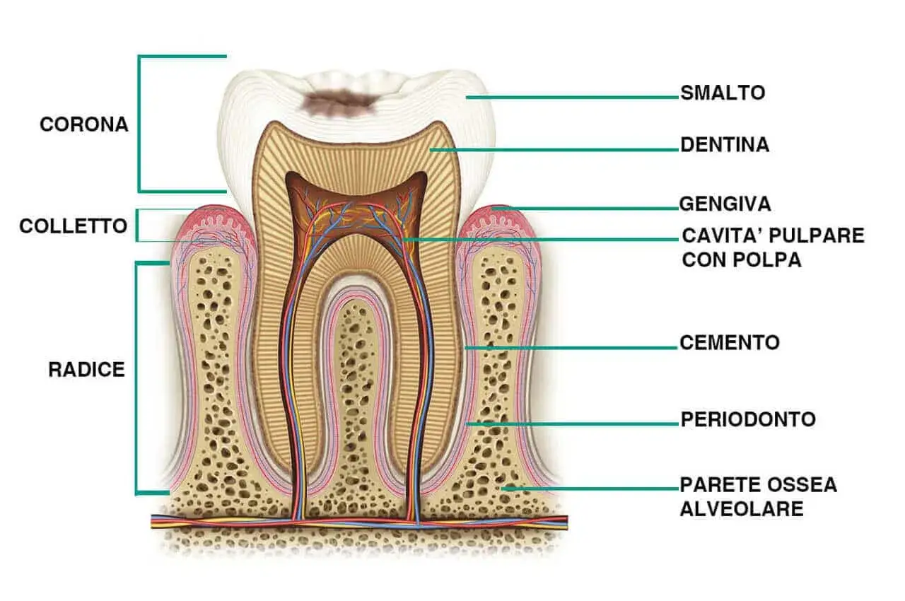 Sezione di un dente che mostra smalto, dentina, polpa e il cemento radicolare che riveste la radice.