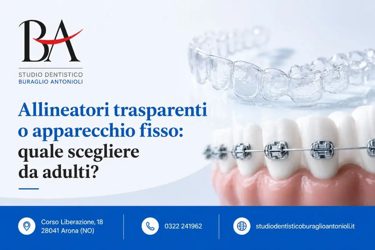 Confronto tra allineatori trasparenti e apparecchio fisso. Valuta le opinioni negative su Invisalign per scegliere la soluzione migliore per adulti.