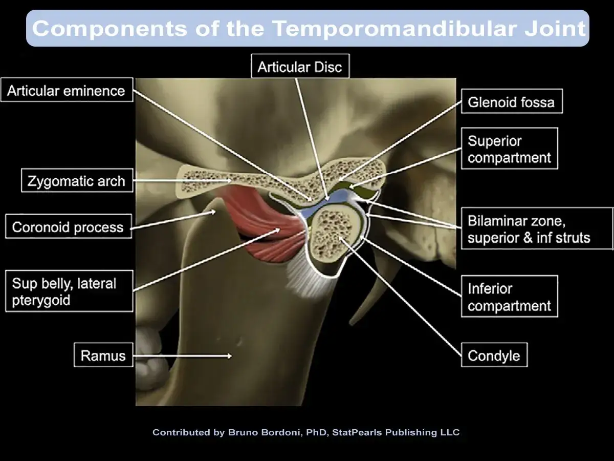Anatomia dell'articolazione temporo-mandibolare, con etichette per le sue componenti. Utile per comprendere la disfunzione temporo-mandibolare.