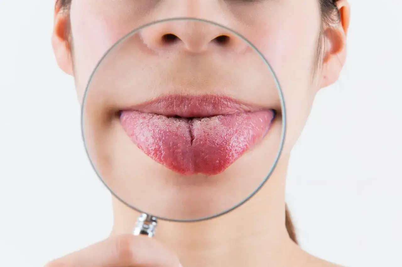 Ingrandimento di una lingua rosa con una patina biancastra, che mostra la sua texture dettagliata.