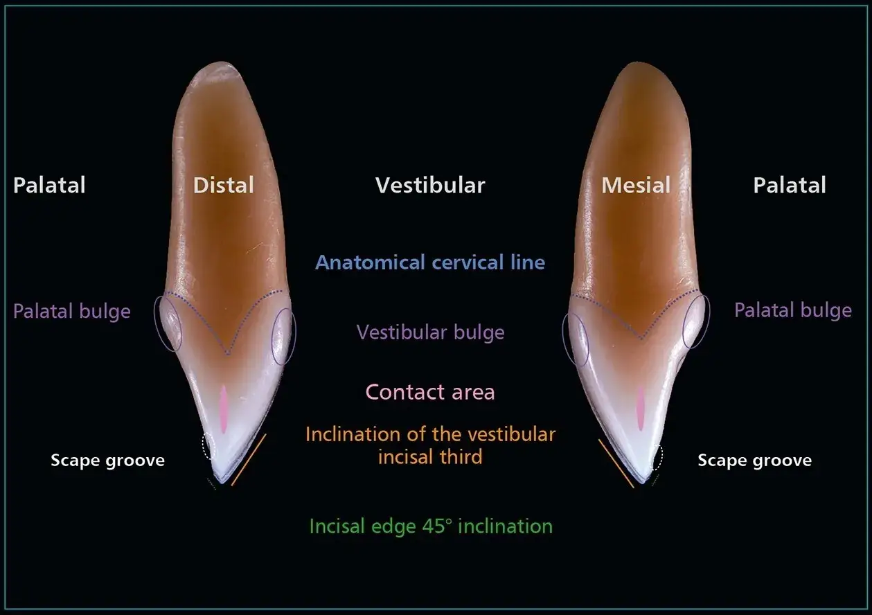 Dettaglio anatomico degli incisivi centrali superiori, con etichette che indicano le varie parti come la linea cervicale, il rigonfiamento vestibolare e palatale, e il solco scanalato.