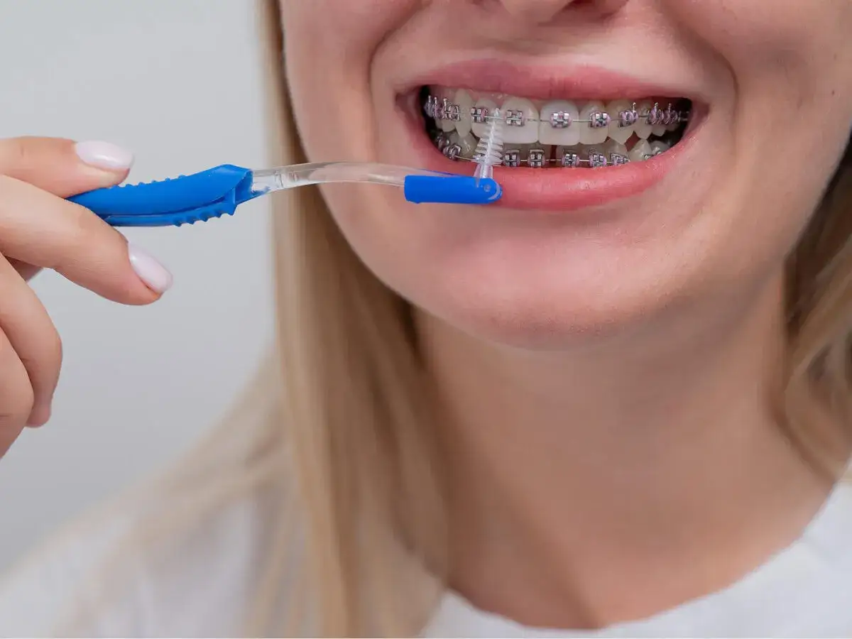 Donna pulisce l'apparecchio con uno scovolino. Si può usare lo spazzolino elettrico con l'apparecchio, ma questo strumento è ideale per le zone difficili da raggiungere.