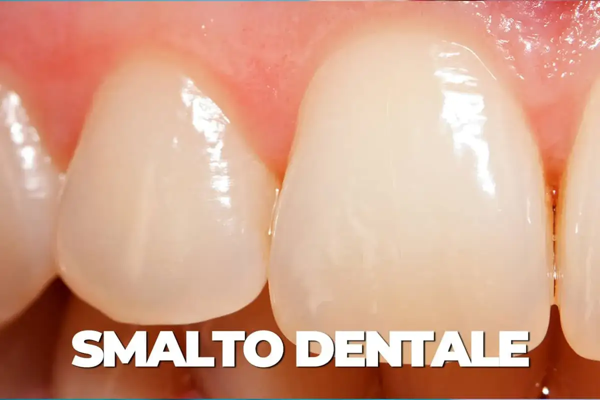 Primo piano di denti sani con smalto lucido. La cura dello smalto dentale previene la sensibilità dentale.