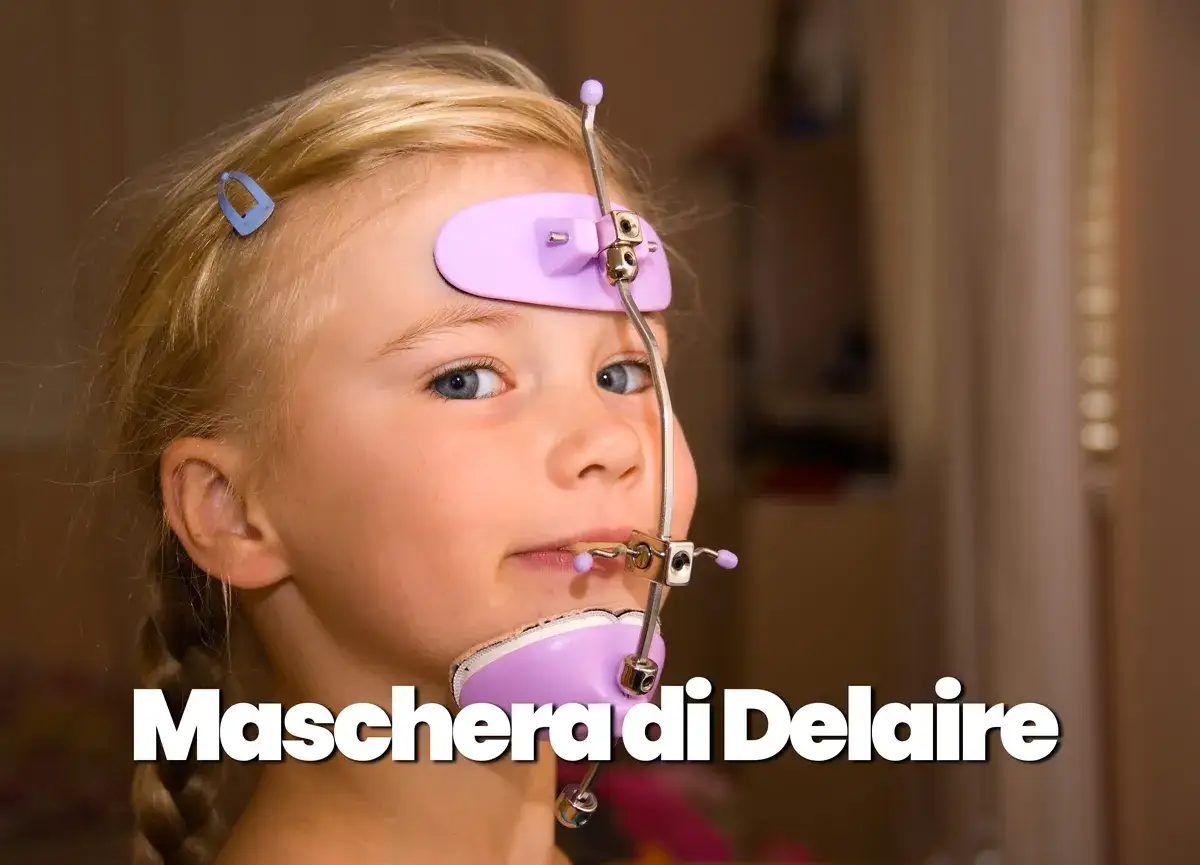 Bambina con maschera Delaire, strumento per l'ortodonzia intercettiva, che corregge la crescita mascellare.