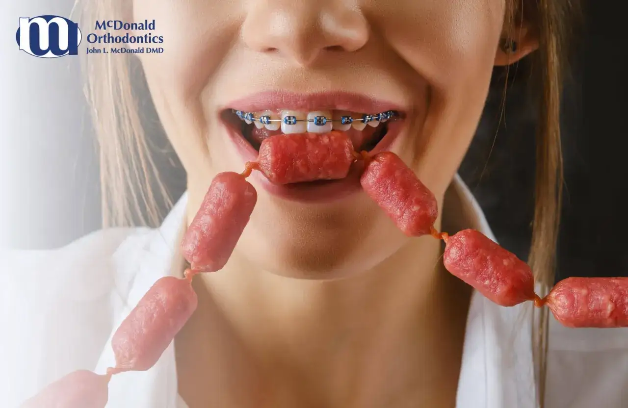 Sorridere con apparecchio fisso può causare dolore nei primi giorni. Qui, una ragazza morde una salsiccia con il suo nuovo apparecchio.