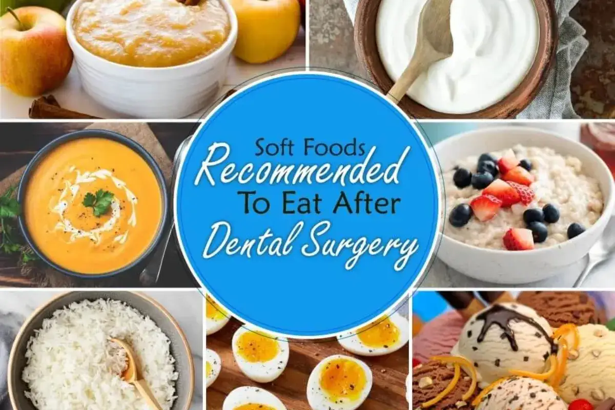 Deliziosi cibi morbidi consigliati per mangiare dopo pulizia denti: pur&egrave; di mele, yogurt, zuppa, porridge, riso, uova sode e gelati.