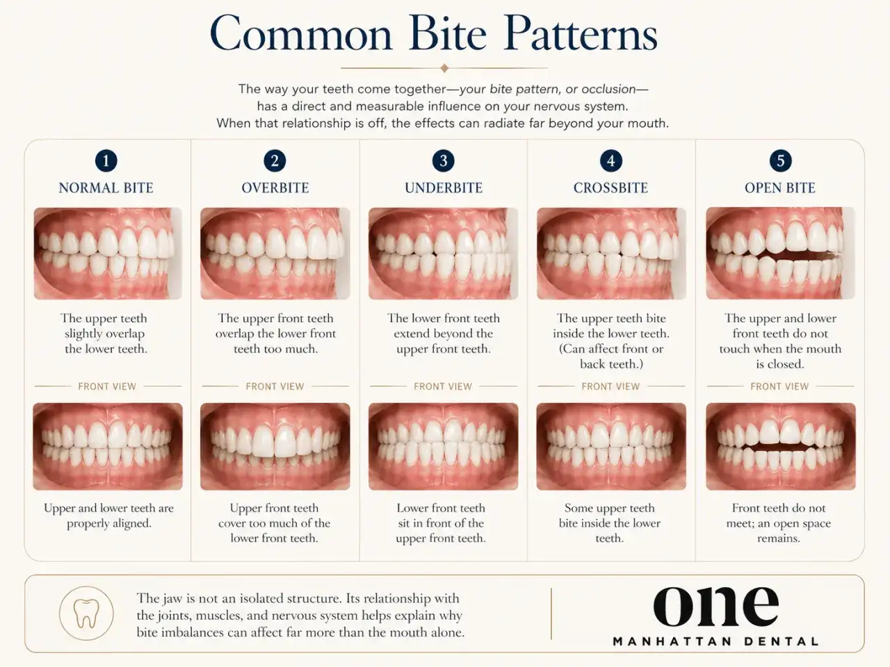 Diversi tipi di malocclusione dentale, come overbite, underbite, crossbite e open bite, possono influenzare il sistema nervoso.