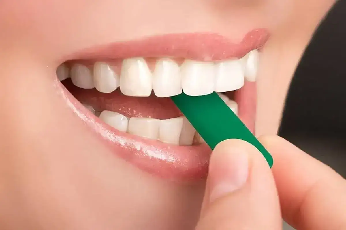 Denti bianchi e labbra rosa, una mano inserisce un chewies invisalign verde tra gli incisivi per un sorriso perfetto.