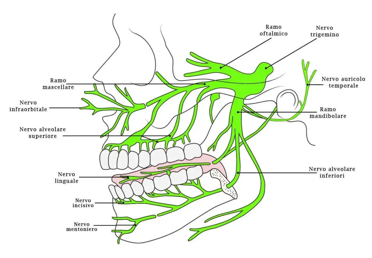 Schema del nervo trigemino, con evidenziati i rami alveolari superiore e inferiore che innervano denti e gengive.
