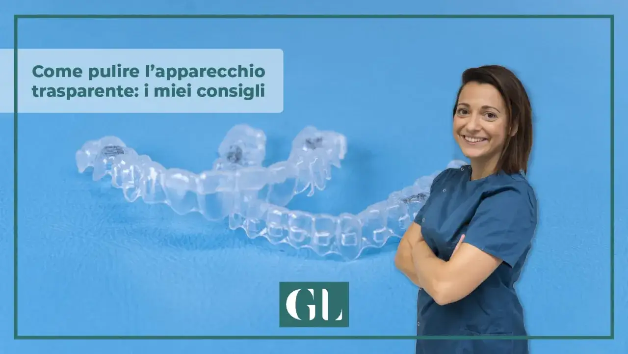 Consigli su come pulire l'apparecchio trasparente. Una donna sorride con un apparecchio trasparente in primo piano.