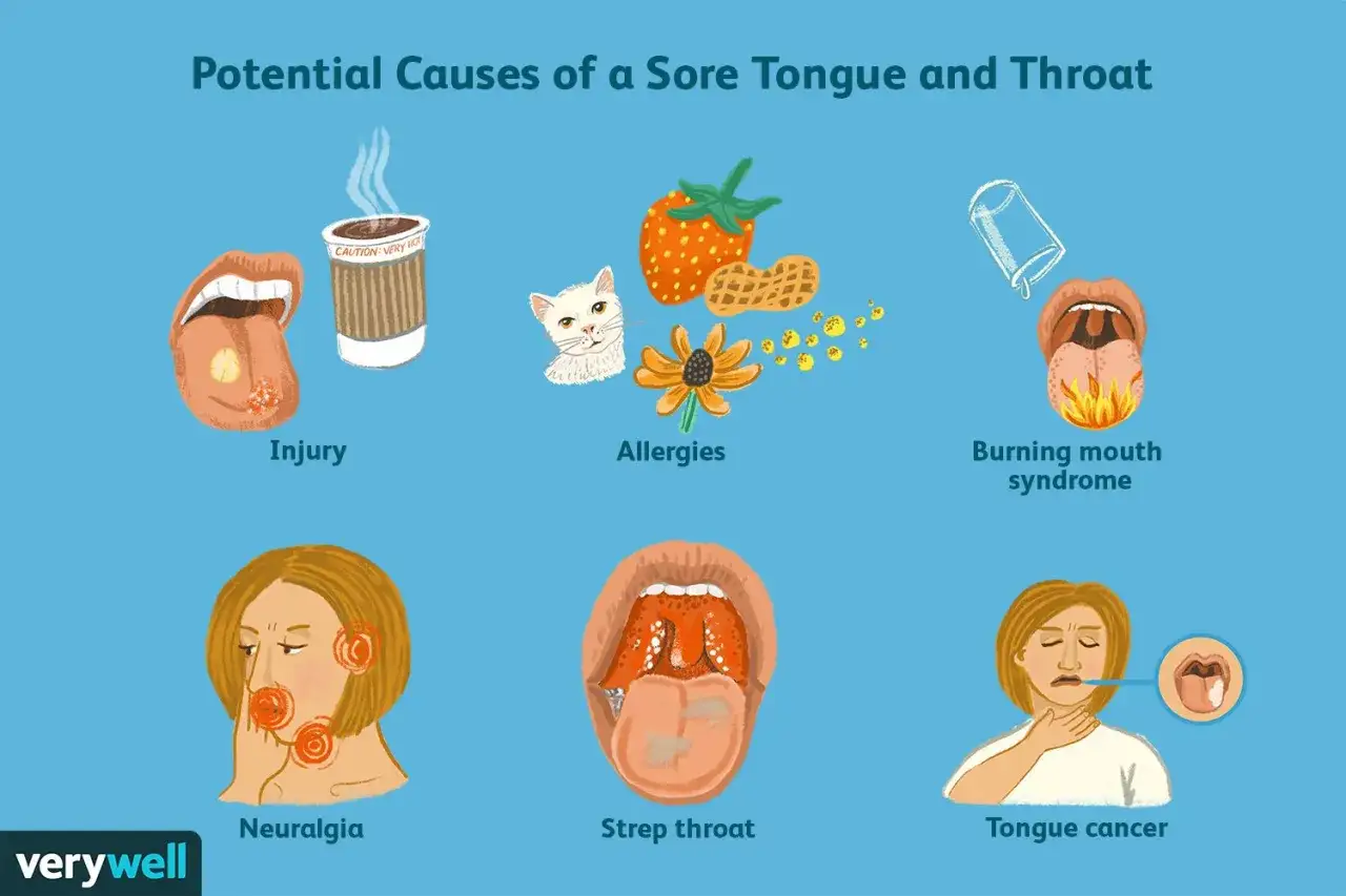 Illustrazione delle cause di dolore alla lingua e alla gola: lesioni, allergie, sindrome della bocca che brucia, nevralgia, mal di gola, cancro alla lingua.