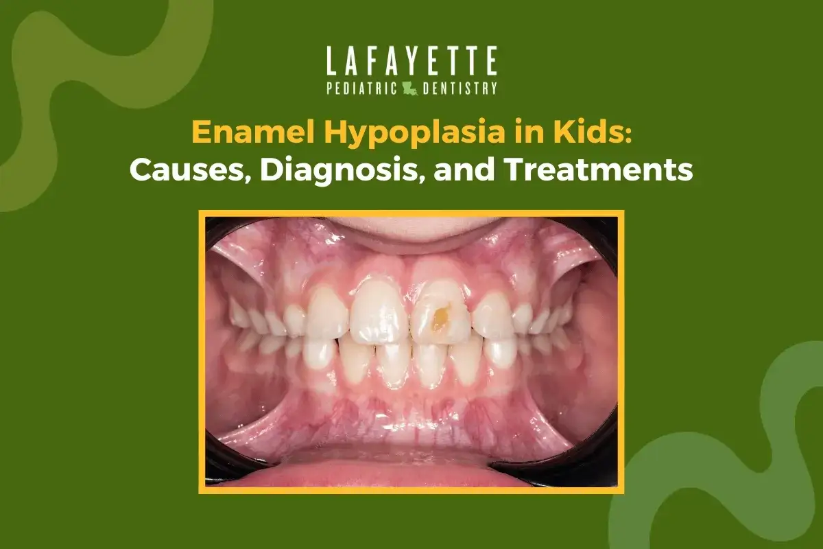 Primo piano dei denti di un bambino con ipomineralizzazione dello smalto, evidenziata da una macchia giallastra su un dente.
