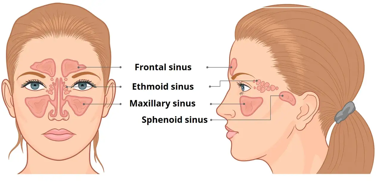 Illustrazione anatomica del volto femminile che evidenzia il seno nasale, con i seni frontale, etmoidale, mascellare e sfenoidale.