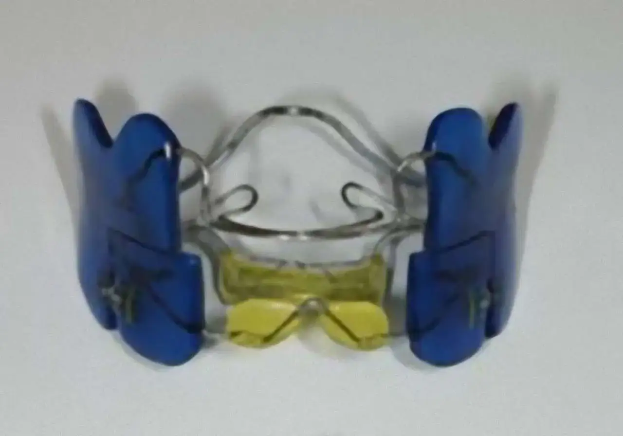 Apparecchio denti anni 80, blu e giallo, con fili metallici. Un ricordo di un sorriso perfetto.