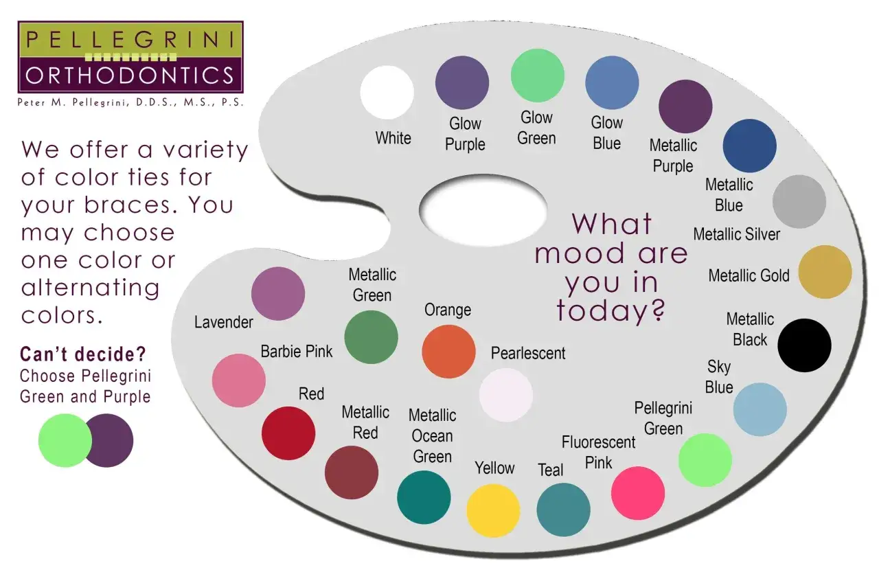 Palette di colori per elastici apparecchio: scegli il tuo umore con tinte vivaci e metalliche.
