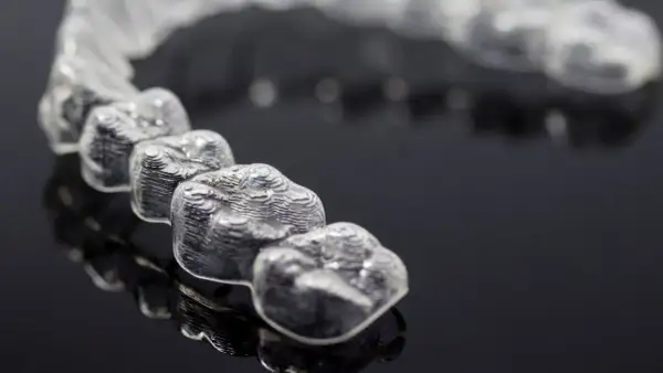 Mascherine trasparenti per allineamento dentale, un esempio di come si presentano i denti con Invisalign. Ogni quanto si cambiano le mascherine?