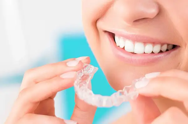 Sorriso smagliante con Invisalign, da indossare 20 ore al giorno per un risultato perfetto.