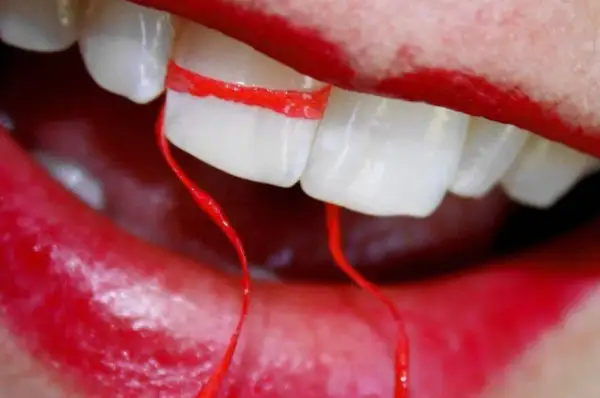Un filo interdentale rosso avvolge due denti, creando un effetto visivo che sembra allargare i denti. Le labbra rosse incorniciano la scena.