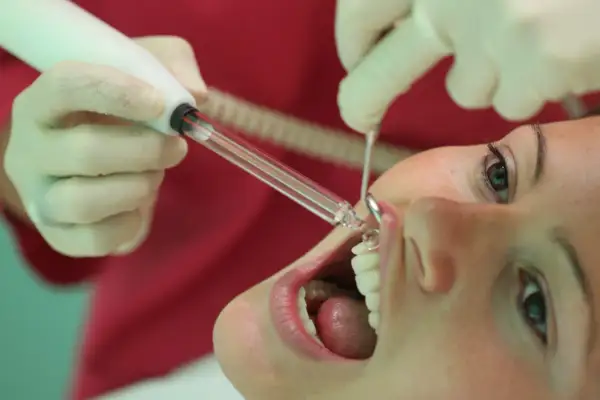 Trattamento dentale con ozono. Un dentista usa uno strumento per applicare il gel ozono sui denti di una paziente.