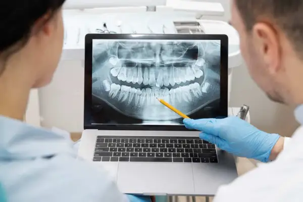 Dentisti analizzano un'ortopanoramica dentale su un laptop, seguendo il principio Alara per minimizzare l'esposizione.