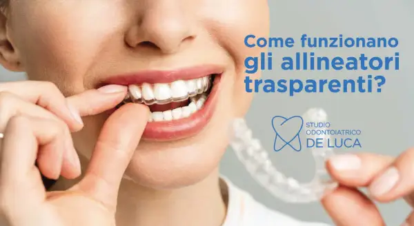 Sorriso smagliante con un apparecchio trasparente. Scopri come funziona questo innovativo trattamento ortodontico.