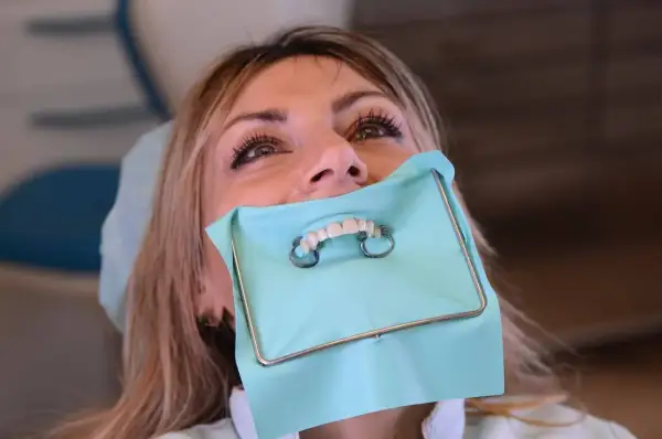 Donna con diga di gomma dentista, pronta per un trattamento.