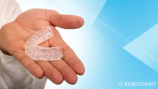 Mano che tiene un bite apparecchio trasparente, utile per proteggere i denti durante il sonno o lo sport.
